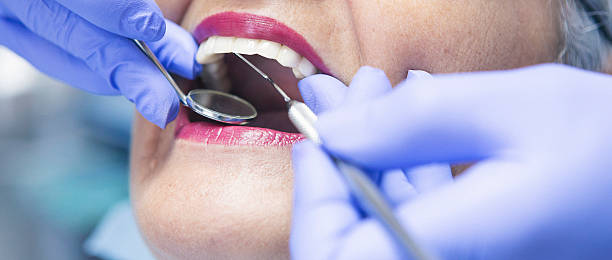 Best Emergency Treatment for Toothache in Fife Heights, WA
